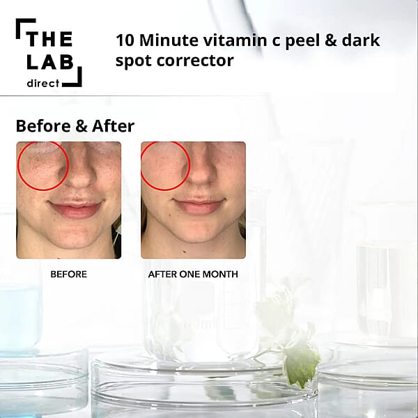 The Lab Direct 10 Minute Vitamin C Peel 2oz (Made In USA) Anti Wrinkle Anti Aging Skin Care Products (Ships In 5-7 Business Days)